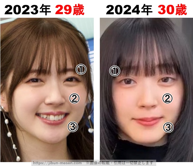 鈴木愛理の整形検証2023年〜2024年の画像