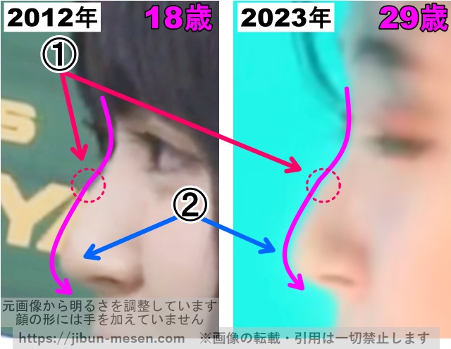 鈴木愛理の鼻の整形検証2012年〜2023年（横顔・拡大）の画像