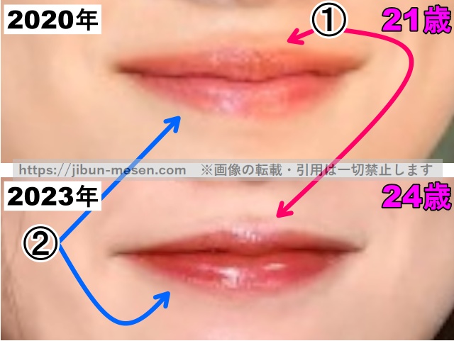 永野芽郁の唇の整形検証2020年～2023年（拡大）の画像