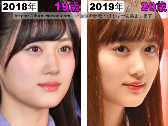 山下美月の目の整形検証2018年〜2019年(横顔)