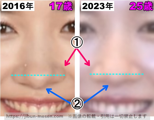 永野芽郁の鼻の整形検証2016年～2023年（拡大）の画像