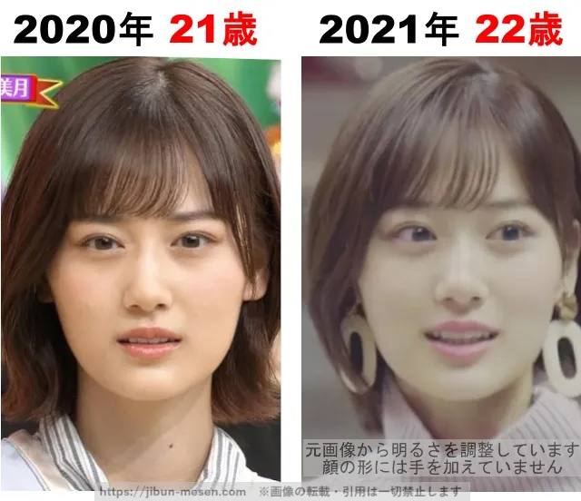 山下美月の整形検証2020年〜2021年