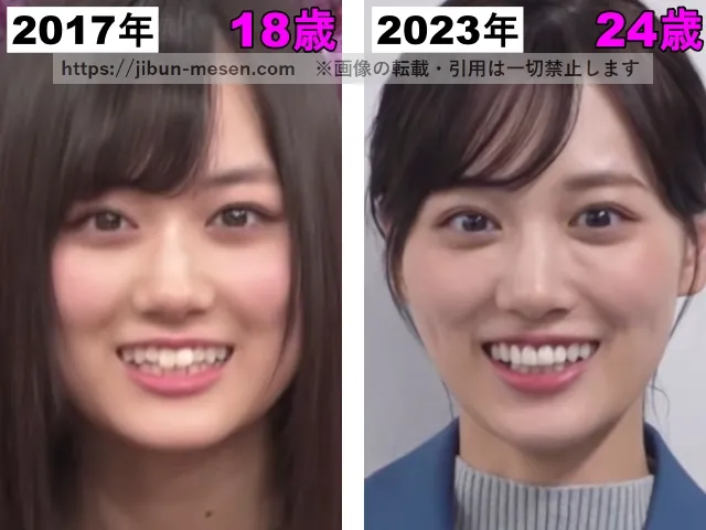 山下美月の鼻の整形検証2017年〜2023年