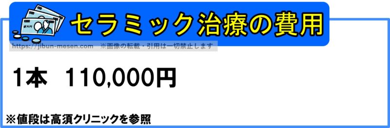 セラミック治療の費用 １本　110,000円 ※値段は高須クリニックを参照