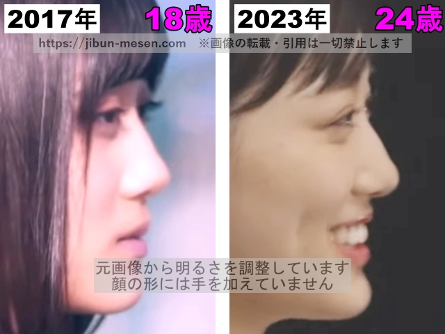 山下美月の鼻の整形検証2017年〜2023年(横顔)の画像