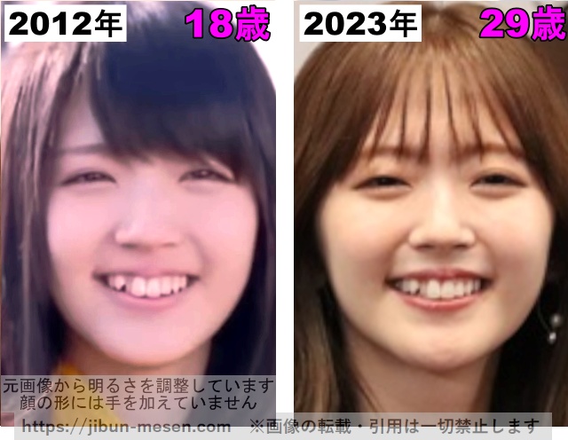 鈴木愛理の鼻の整形検証2012年〜2023年の画像