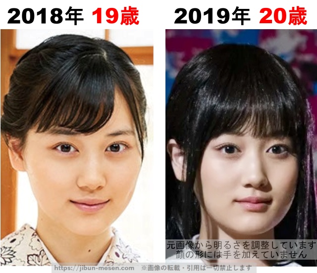 山下美月の整形検証2018年〜2019年の画像