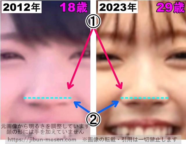 鈴木愛理の鼻の整形検証2012年〜2023年（拡大）の画像