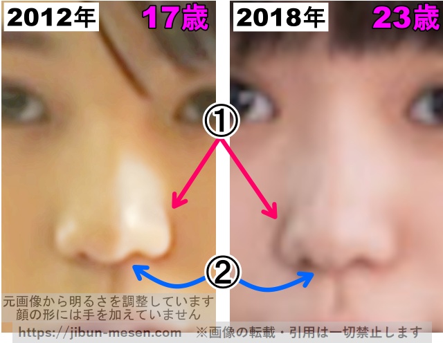 奈緒の鼻の整形検証2012年〜2018年（拡大）の画像