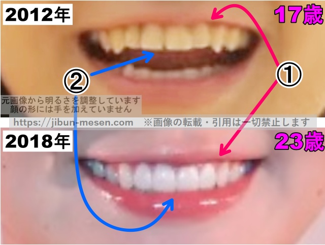 奈緒の歯並びの比較2012年〜2018年（拡大）の画像