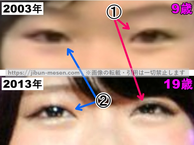 鈴木愛理の目の整形検証2003年〜2013年（拡大）の画像