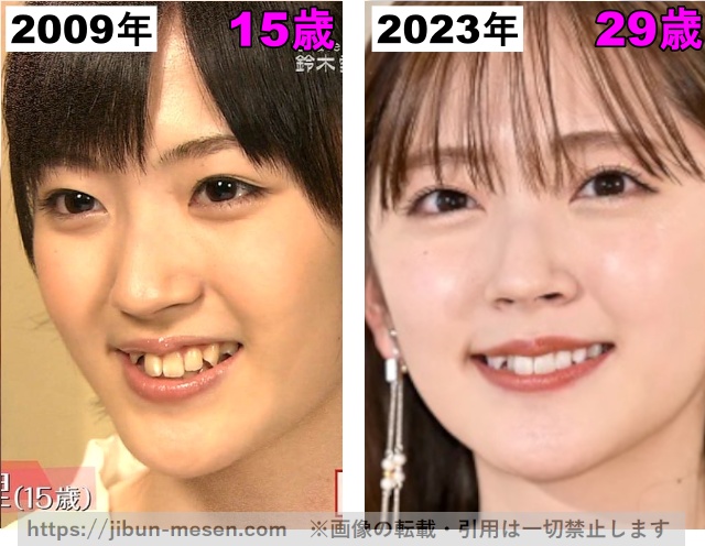 鈴木愛理の唇の整形検証2009年〜2023年の画像