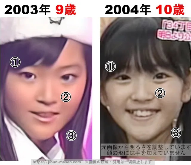 鈴木愛理の整形検証2003年〜2004年