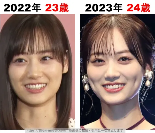 山下美月の整形検証2022年〜2023年