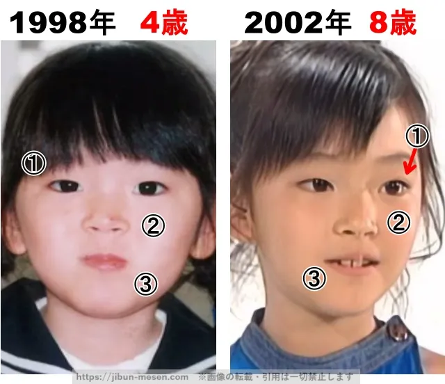 鈴木愛理の整形検証1998年〜2002年
