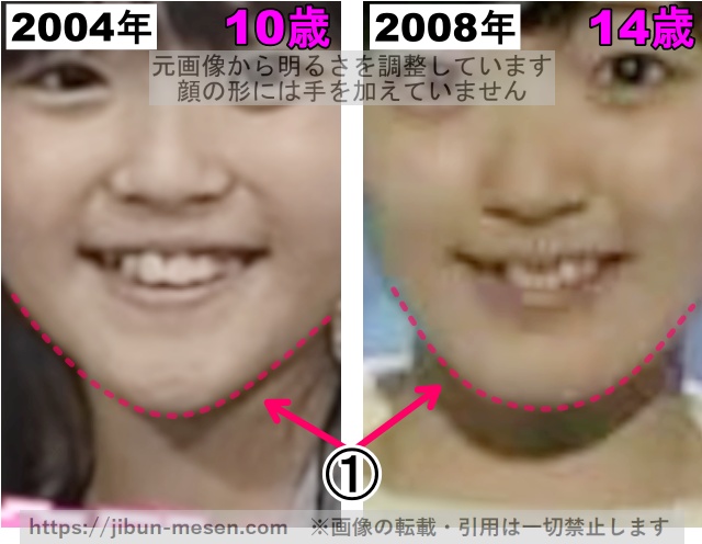 鈴木愛理の顎の整形検証2004年〜2008年（拡大）の画像