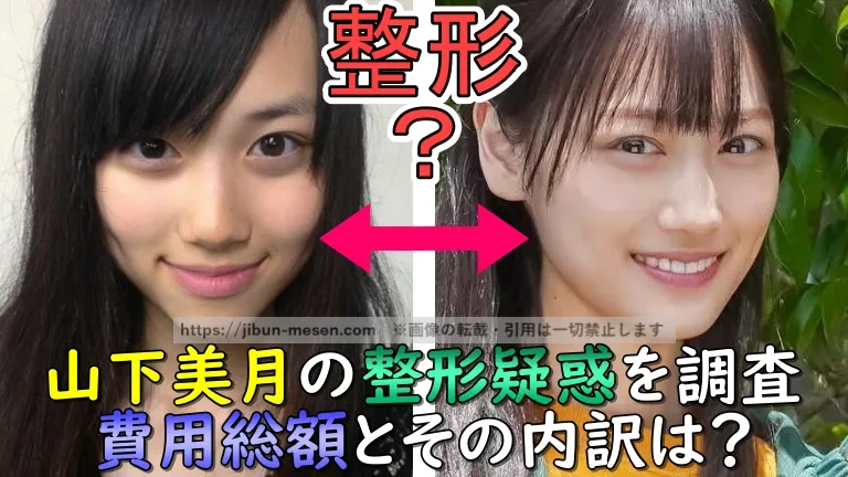 山下美月の整形疑惑を調査　費用総額とその内訳は？