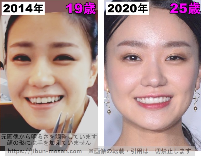 奈緒の目の整形検証2014年〜2020年の画像