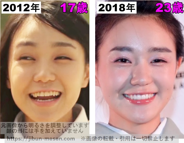 奈緒の歯並びの比較2012年〜2018年の画像