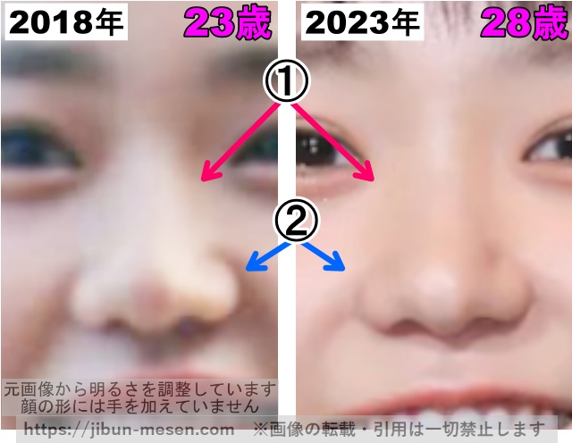奈緒の鼻の整形検証2018年〜2023年（拡大）の画像