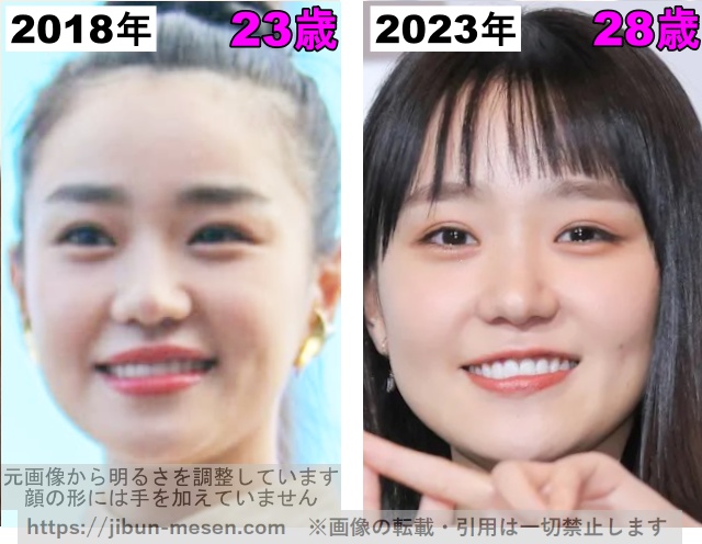 奈緒の鼻の整形検証2018年〜2023年の画像