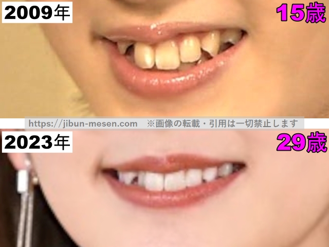 鈴木愛理の唇の比較2009年～2023年の画像