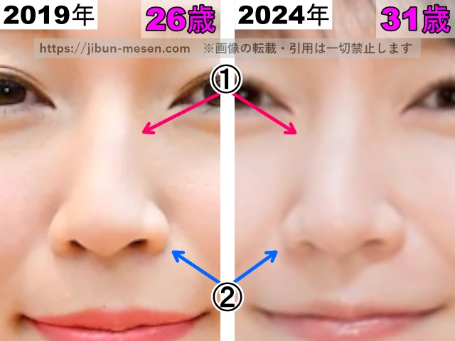 吉岡里帆の鼻の整形検証2019年〜2024年（拡大）の画像