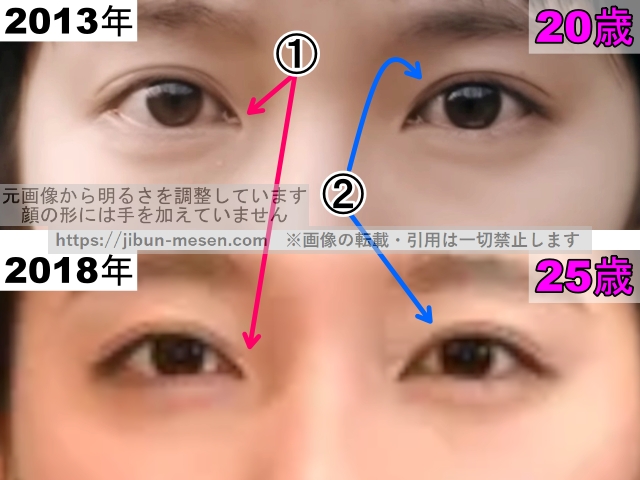 吉岡里帆の目の整形検証2013年〜2018年（拡大）の画像