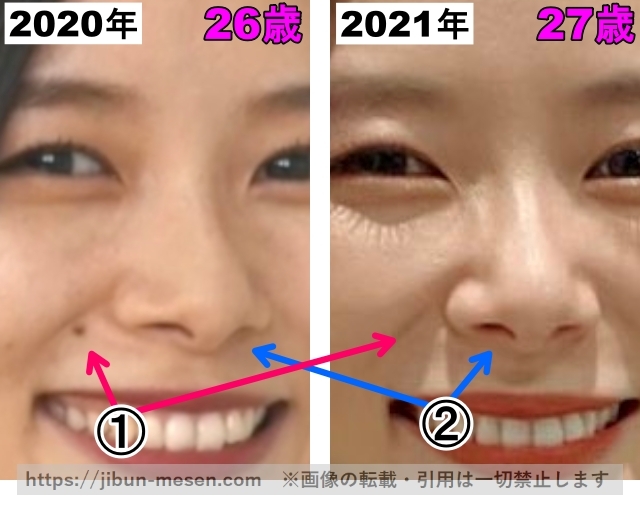 朝日奈央の鼻の整形検証2020年～2021年（拡大）の画像
