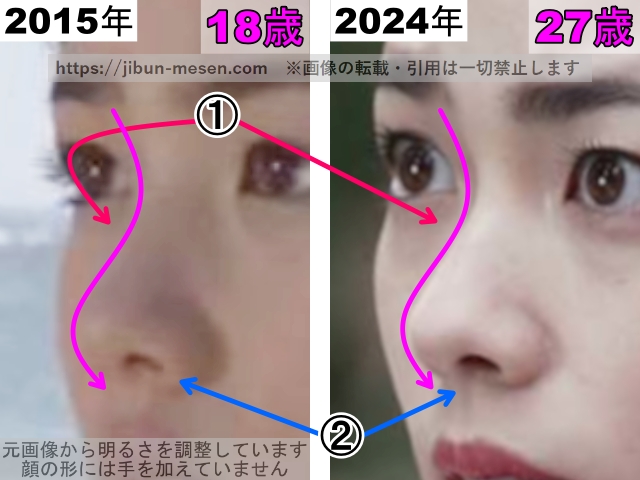 小芝風花の鼻の整形検証2015年〜2024年（横顔・拡大）の画像