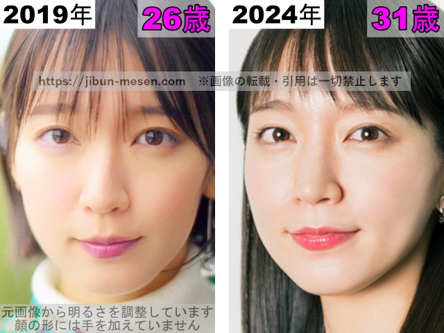 吉岡里帆の唇の整形検証2019年〜2024年の画像