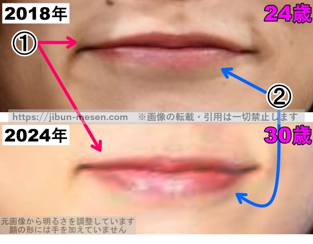朝日奈央の唇の整形検証2018年～2024年（拡大）の画像