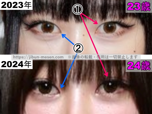 ジゼルの目の整形検証2023年〜2024年（拡大）の画像