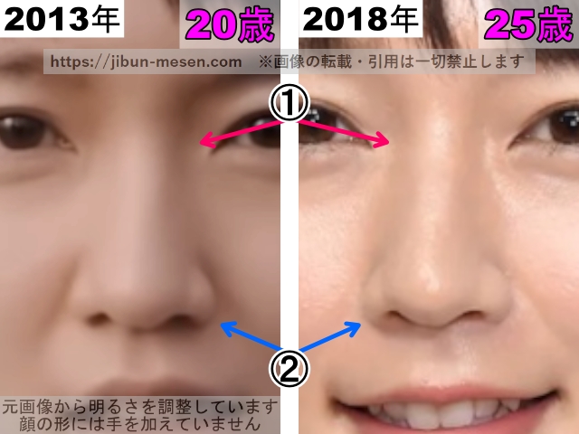 吉岡里帆の鼻の整形検証2013年〜2018年（拡大）の画像