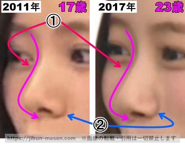 朝日奈央の鼻の整形検証2011年～2017年（拡大）の画像