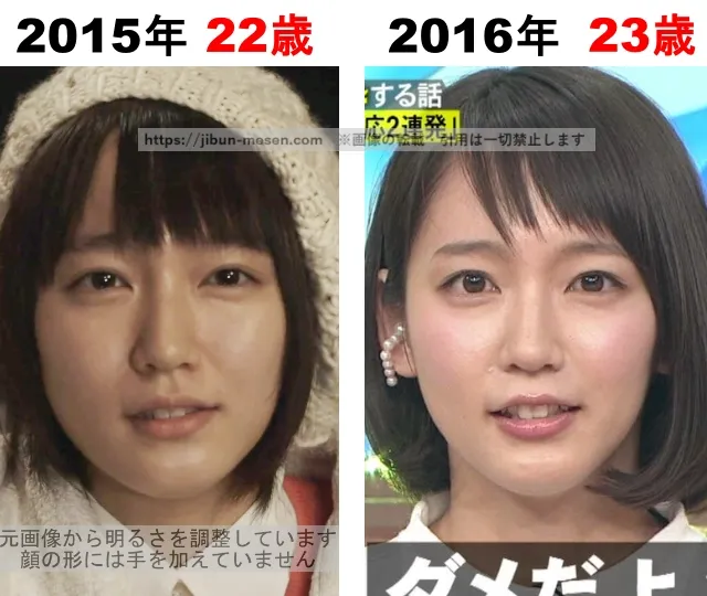 吉岡里帆の整形検証2015年〜2016年