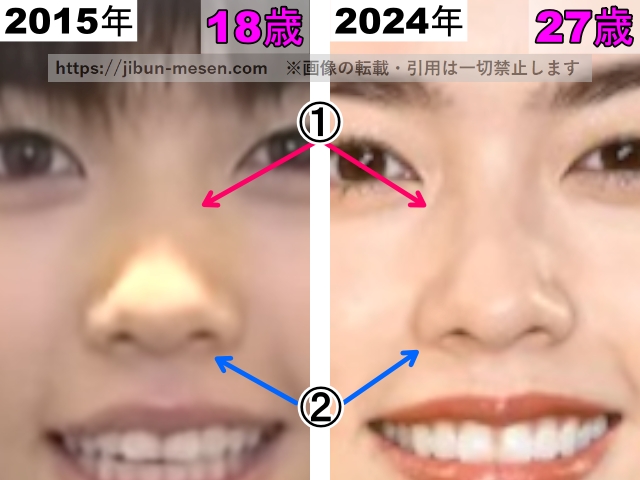 小芝風花の鼻の整形検証2015年〜2024年（拡大）の画像