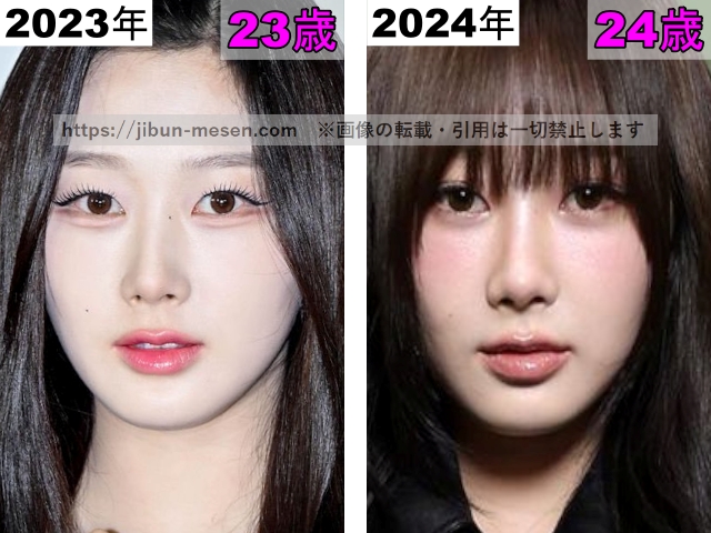 ジゼルの唇の整形検証2023年～2024年の画像