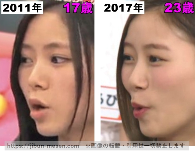 朝日奈央の鼻の整形検証2011年～2017年の画像