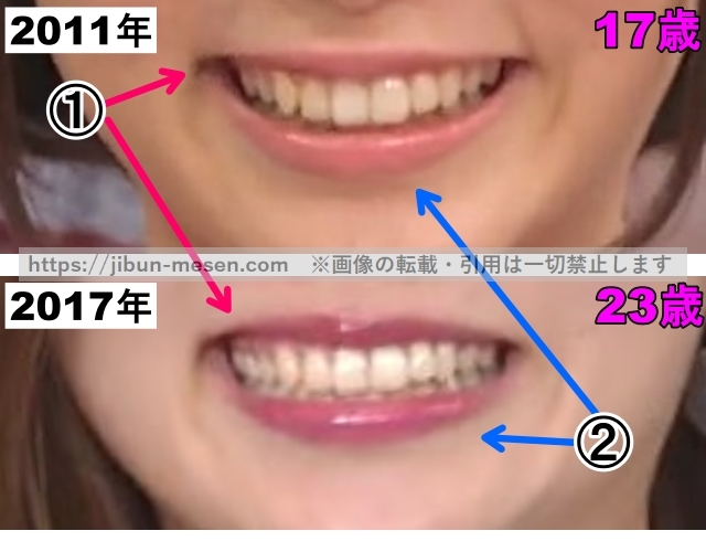 朝日奈央の唇の整形検証2011年～2017年（拡大）の画像