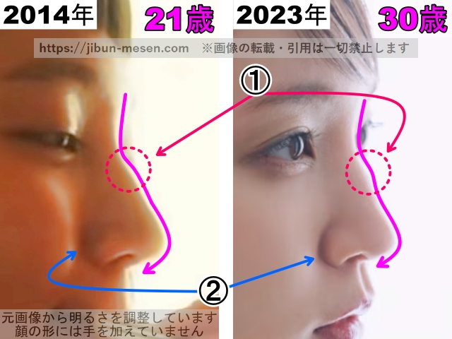 吉岡里帆の鼻の整形検証2014年～2023年（拡大）の画像