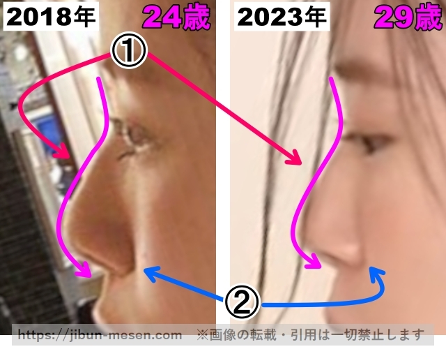 朝日奈央の鼻の整形検証2018年～2023年（拡大）の画像