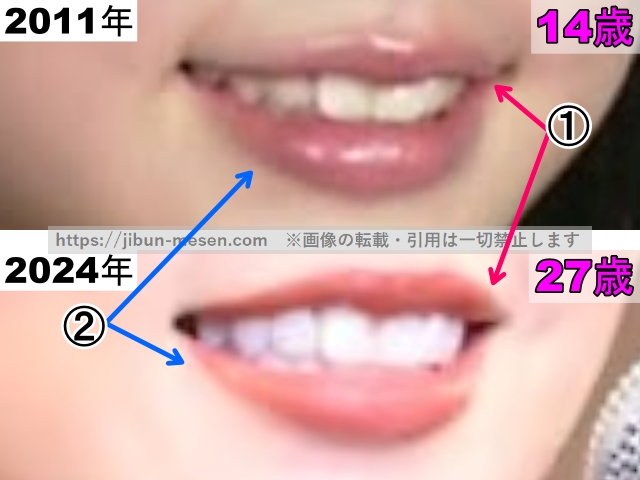 小芝風花の唇の整形検証2011年〜2024年（拡大）の画像
