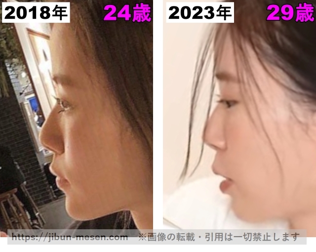 朝日奈央の鼻の整形検証2018年～2023年の画像