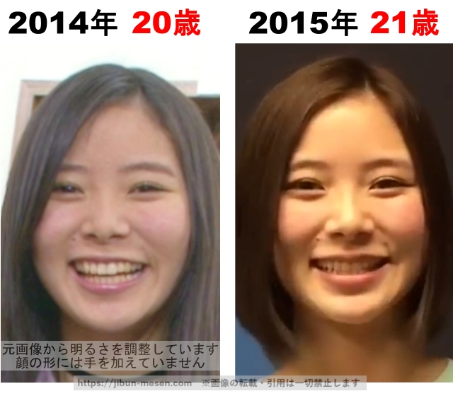 朝日奈央の整形検証2014年～2015年の画像