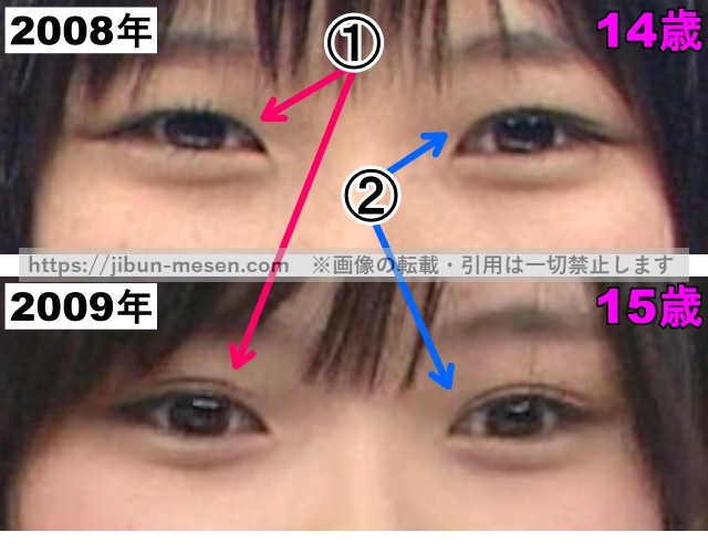 朝日奈央の目の整形検証2008年～2009年（拡大）の画像