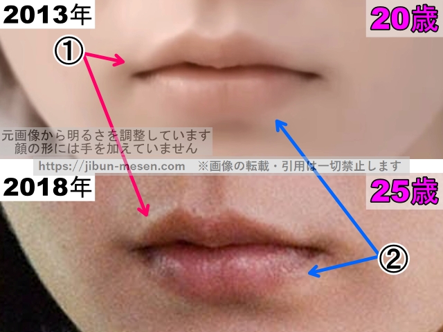 吉岡里帆の唇の整形検証2013年〜2018年（拡大）の画像