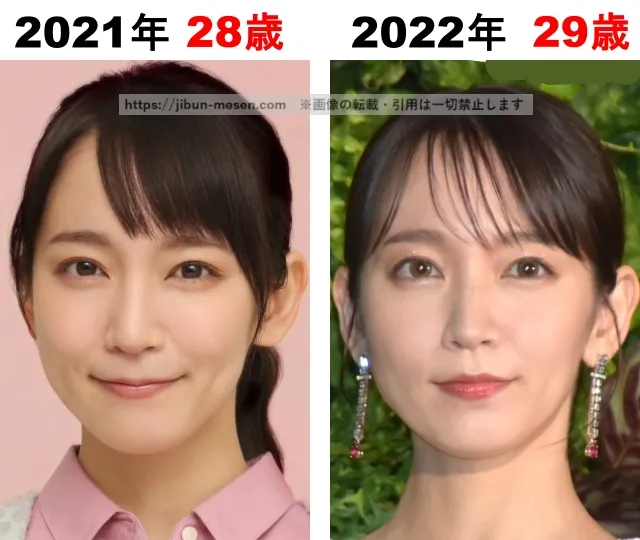 吉岡里帆の整形検証2021年〜2022年
