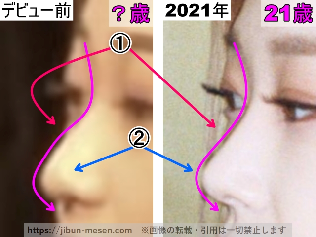 ジゼルの鼻の整形検証デビュー前〜2021年（拡大）の画像