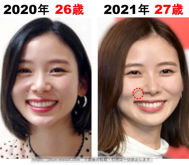 朝日奈央の整形検証2020年～2021年の画像